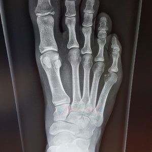 Meet your Posher, Jacques andre